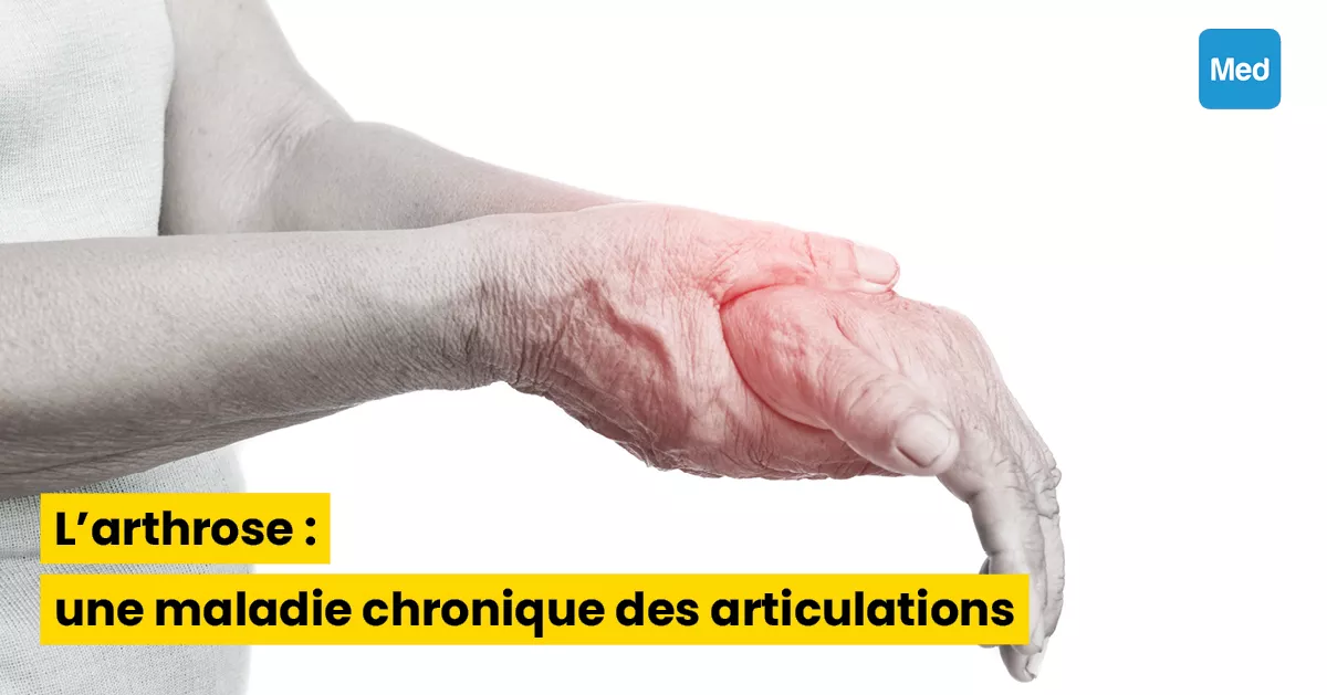 L'arthrose : une maladie chronique des articulations